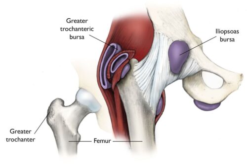 GTPS Trochanteric Bursa Image- anatomy Physical Therapy
